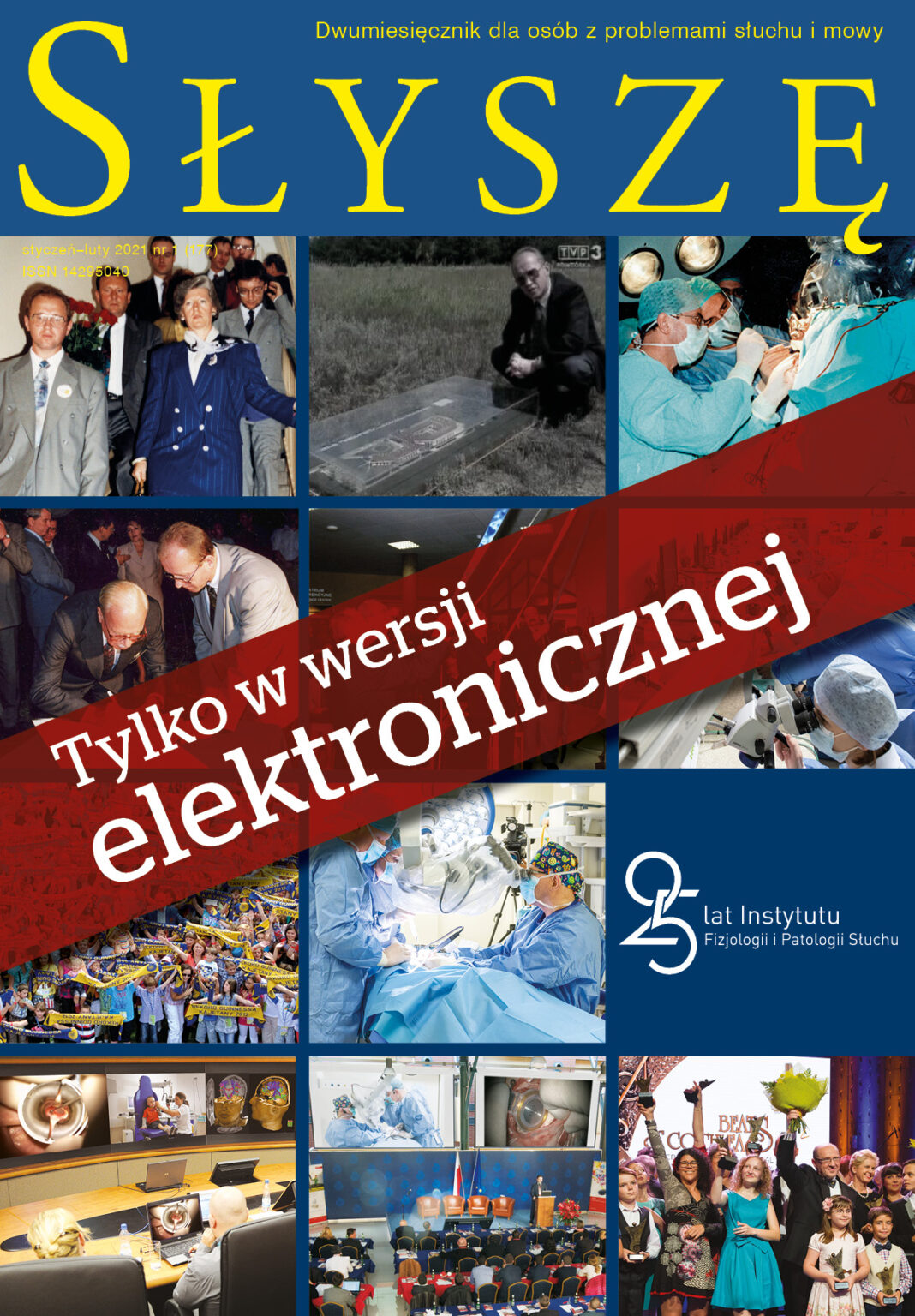 Instytut Fizjologii I Patologii Słuchu Ul Mochnackiego 10 25 lat Instytutu Fizjologii i Patologii Słuchu | Słyszę